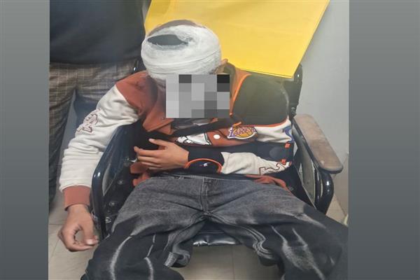 Injured teen receives treatment after alleged assault in Vikas Nagar.